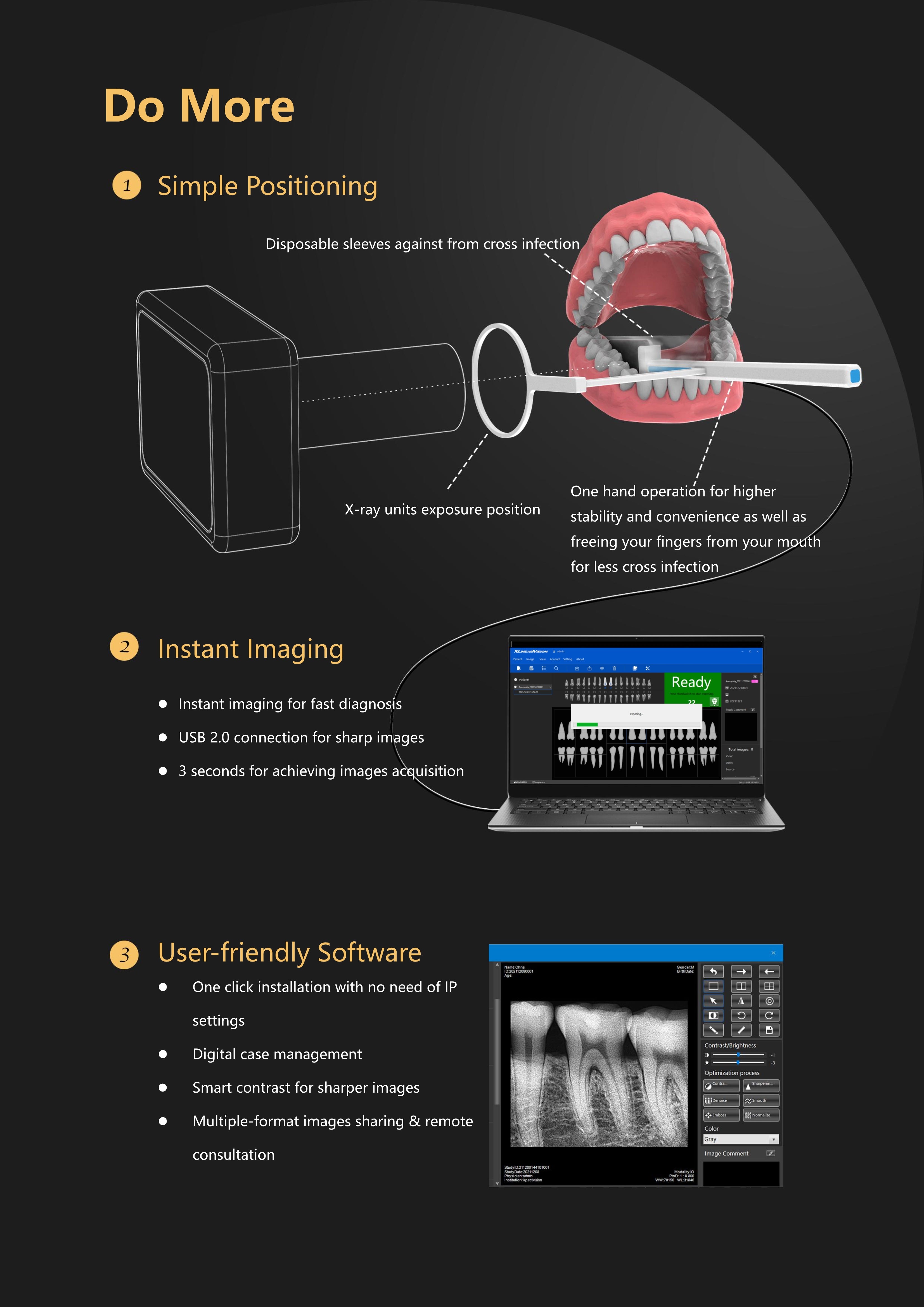 Dental Sensor XVD