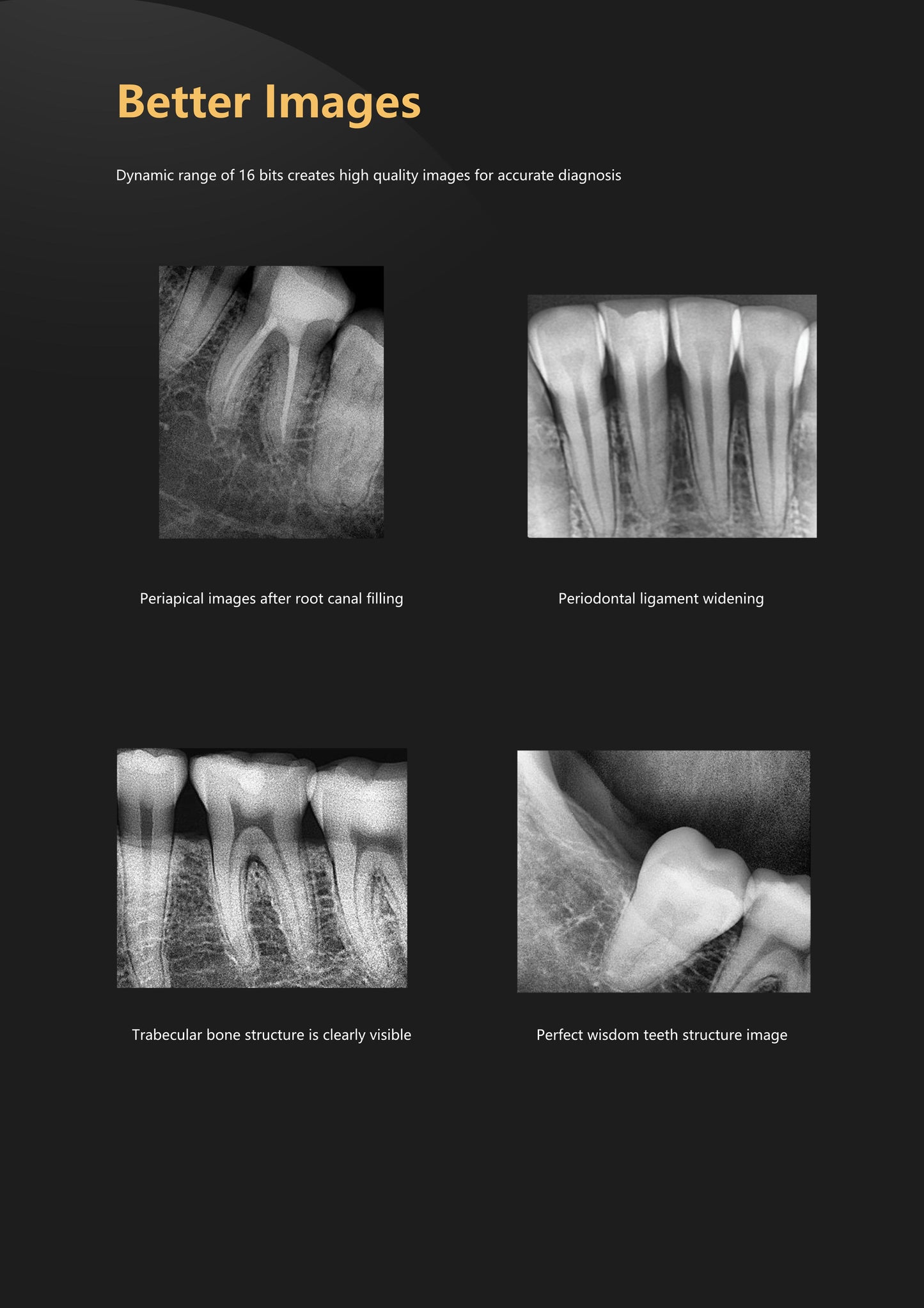 Dental Sensor XVD