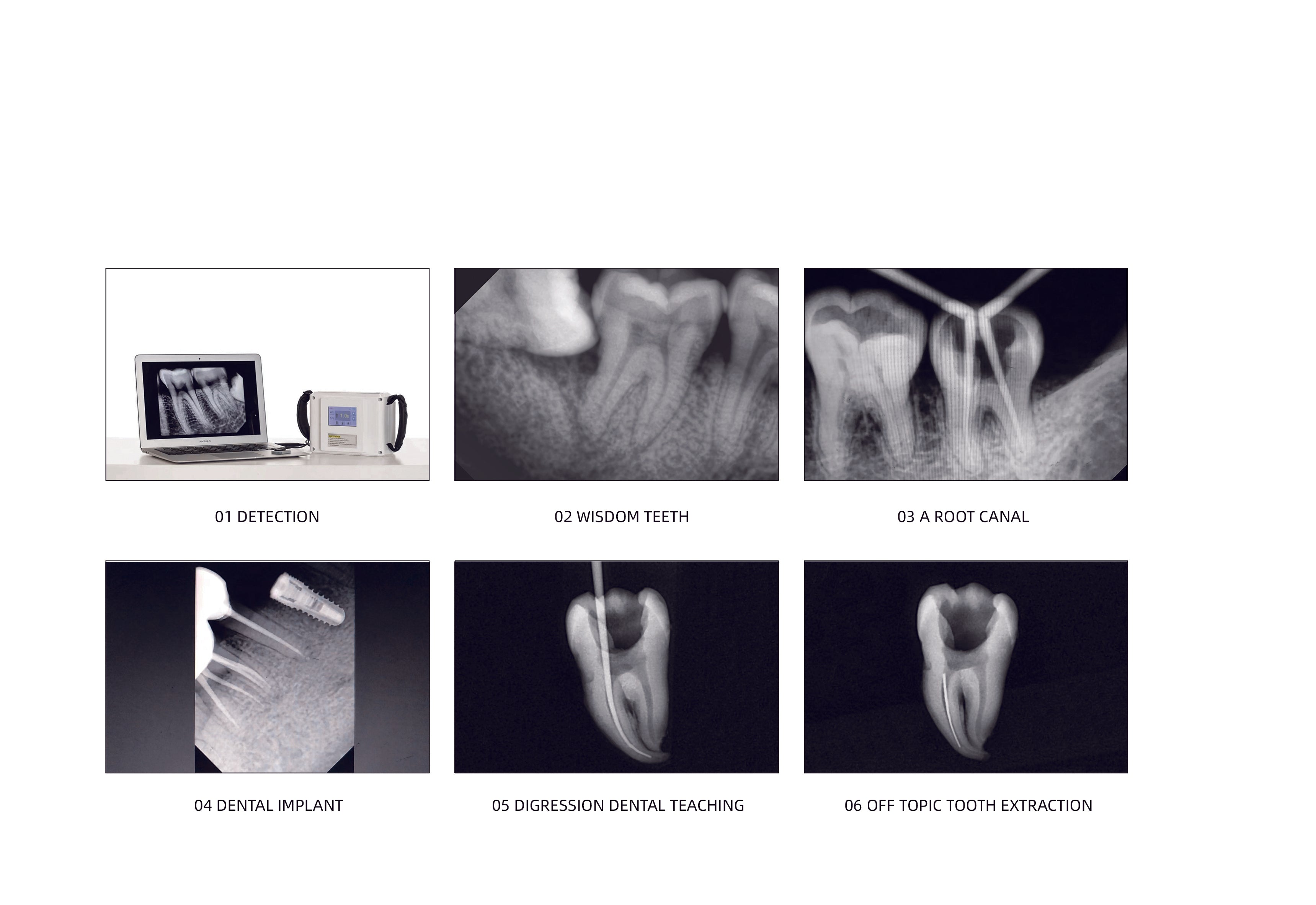 Dental X-RAY 5( E-VO)